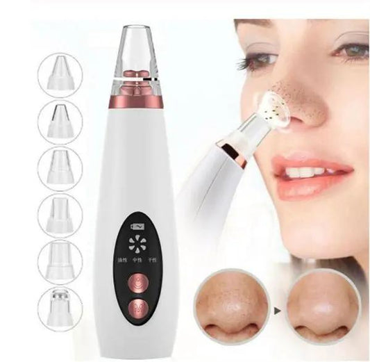 LY 9128 Blackhead Remover Vacuum Pore Cleaner For Household Use Suction Up To 53KPa 2.5W 3.7V by null