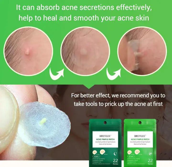 Tea Tree Acne Patch Ultra Thin Transparent Hydrocolloid Absorbs Secretions Fades Acne Marks by null
