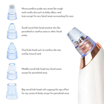 Compact Electric Pore Vacuum Blackhead Remover Device For Acne Facial Skin Cleaner With Suction by null