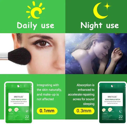 Tea Tree Acne Patch Ultra Thin Transparent Hydrocolloid Absorbs Secretions Fades Acne Marks by null