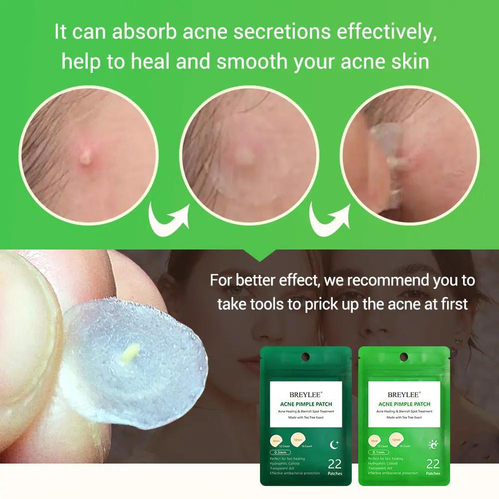 Tea Tree Acne Patch Ultra Thin Transparent Hydrocolloid Absorbs Secretions Fades Acne Marks by null