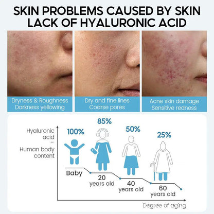 Hyaluronic Acid Serum for Anti Aging Pore Tightening Brightening Moisturizing Dry Skin Care 15ml Stock Solution Series by null