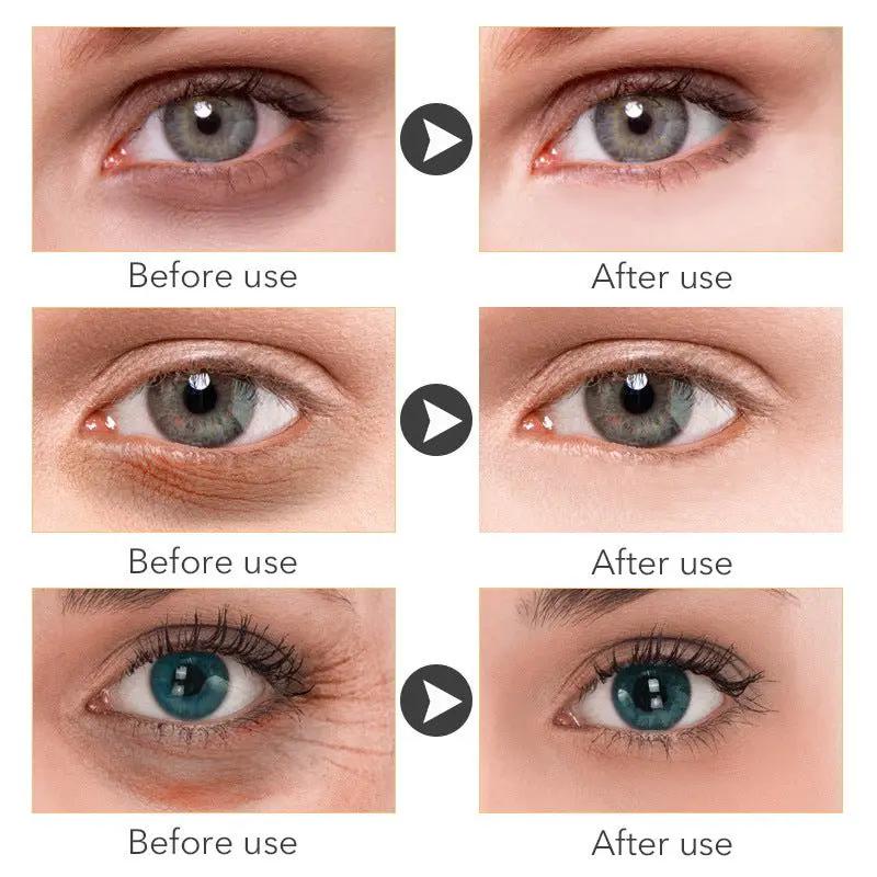 Beauty Eye Cream 30ml Hydrating Anti Aging Eye Treatment For Women Skincare Wish by null