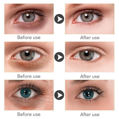 Beauty Eye Cream 30ml Hydrating Anti Aging Eye Treatment For Women Skincare Wish by null