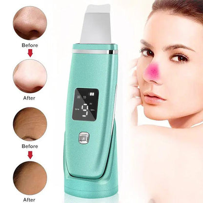 Ultrasonic Vibration Blackhead Remover Deep Cleansing Face Scrubber Pore Cleaner Lifting EMS Microcurrent Led Peeling by null