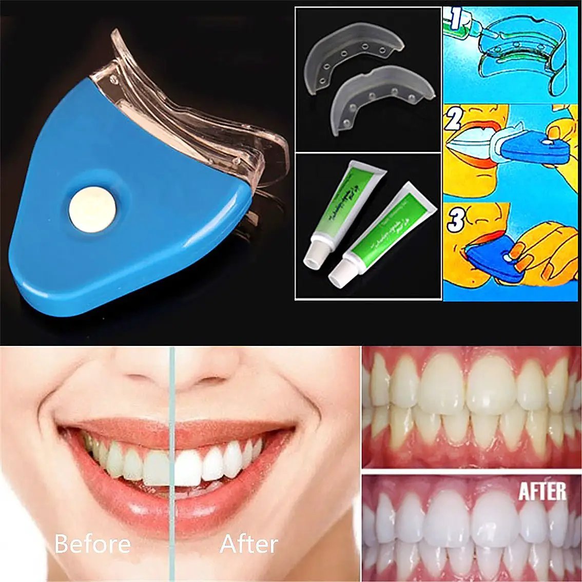 Oral Gel Teeth Whitening Whitener LED Light Dental Bleaching At Home Whitening System by null