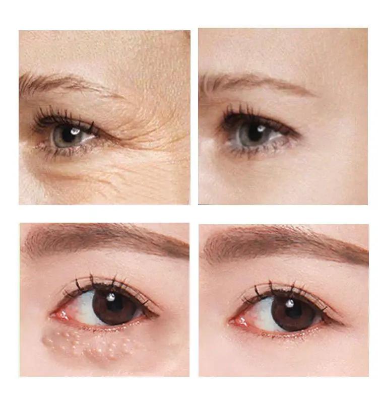 Beauty Eye Cream 30ml Hydrating Anti Aging Eye Treatment For Women Skincare Wish by null